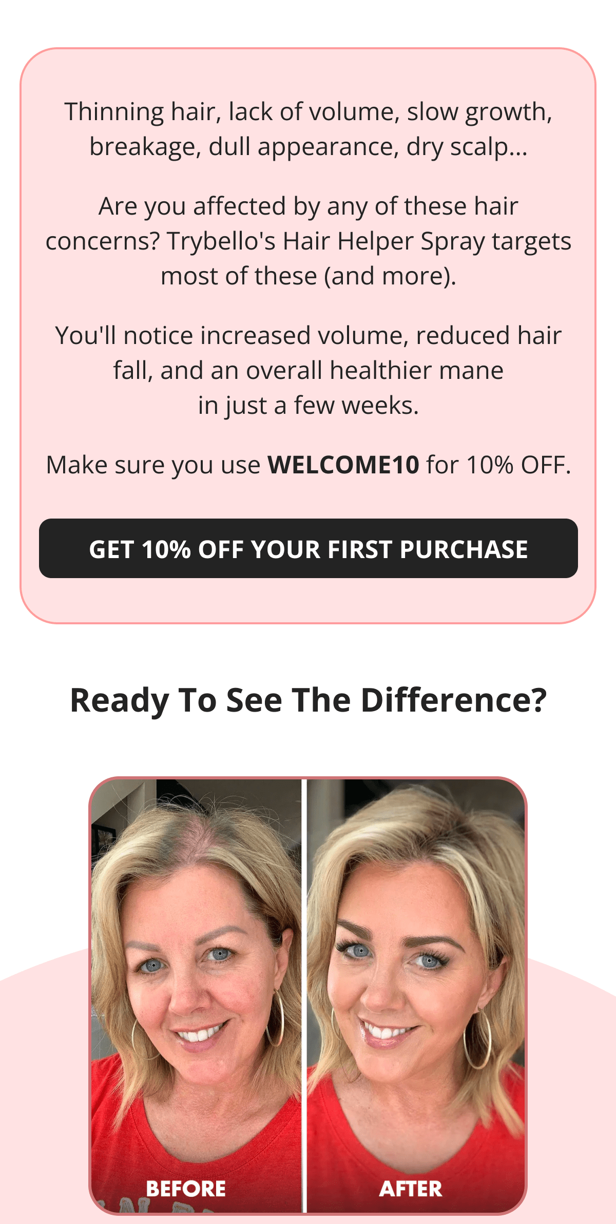 Thinning hair, lack of volume, slow growth, breakage, dull appearance, dry scalp... Are you affected by any of these hair concerns? Trybello's Hair Helper Spray targets most of these (and more). You'll notice increased volume, reduced hair fall, and an overall healthier mane in just a few weeks. Make sure you use WELCOME10 for 10% OFF. GET 10% OFF YOUR FIRST PURCHASE