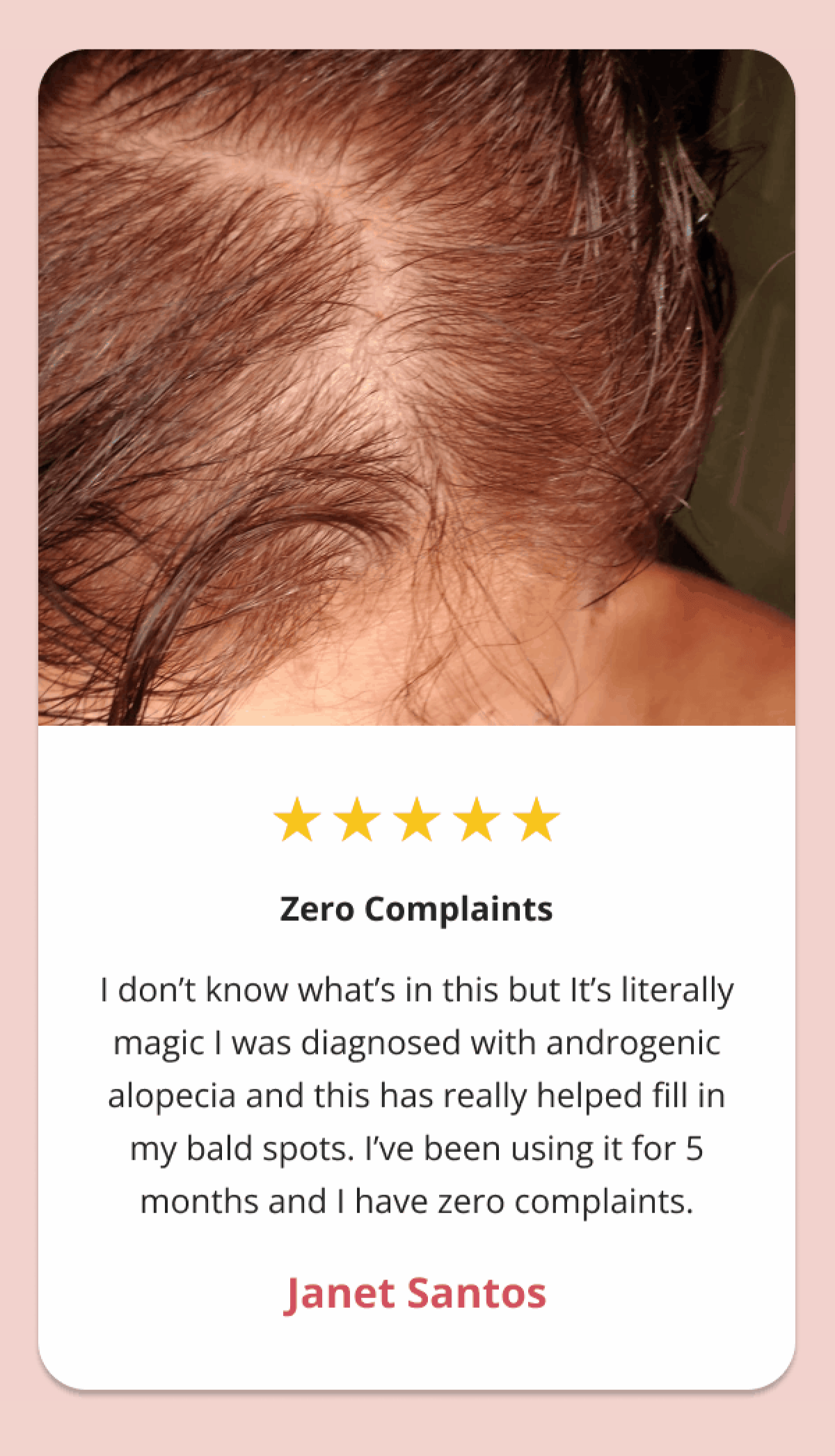 Zero Complaints I don't know what's in this but It's literally magic I was diagnosed with androgenic alopecia and this has really helped fill in my bald spots. I've been using it for 5 months and I have zero complaints.