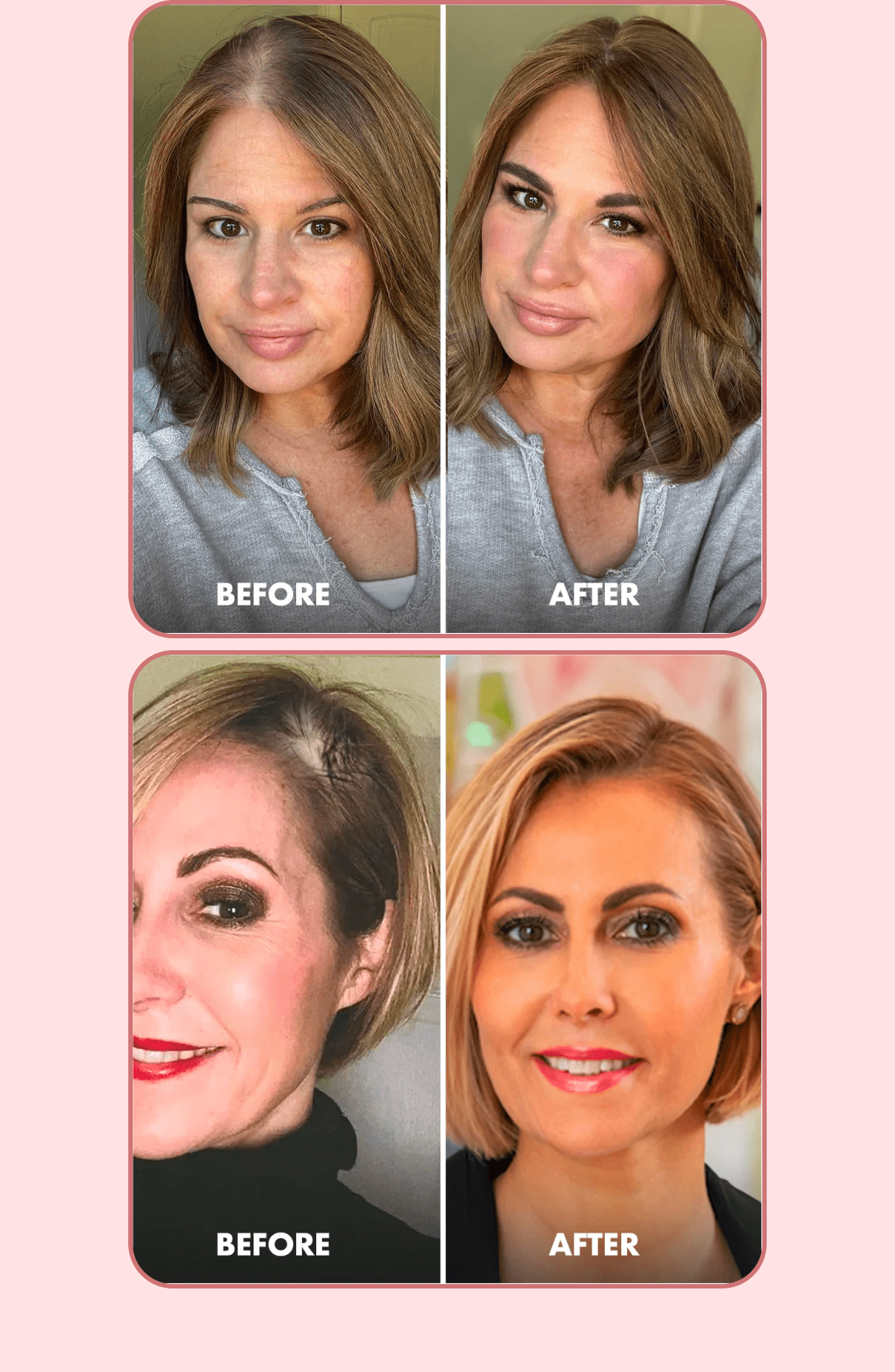 Thinning hair, lack of volume, slow growth, breakage, dull appearance, dry scalp... Are you affected by any of these hair concerns? Trybello's Hair Helper Spray targets most of these (and more). You'll notice increased volume, reduced hair fall, and an overall healthier mane in just a few weeks. Make sure you use WELCOME10 for 10% OFF. GET 10% OFF YOUR FIRST PURCHASE