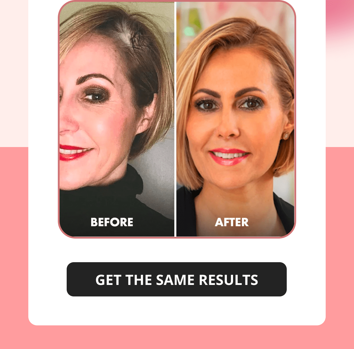 45% fuller hair in just 16 weeks See why THOUSANDS of women are making the switch