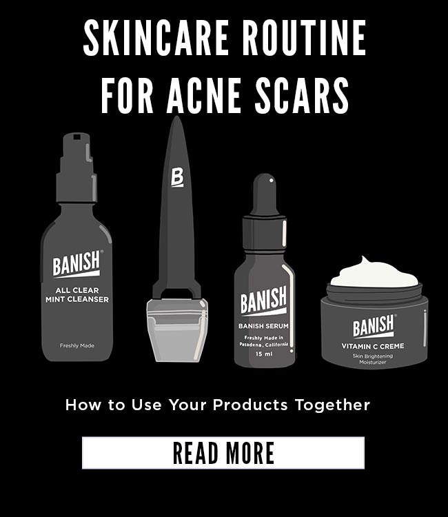 Layering A Skincare Routine For Acne Scars How To Guide!